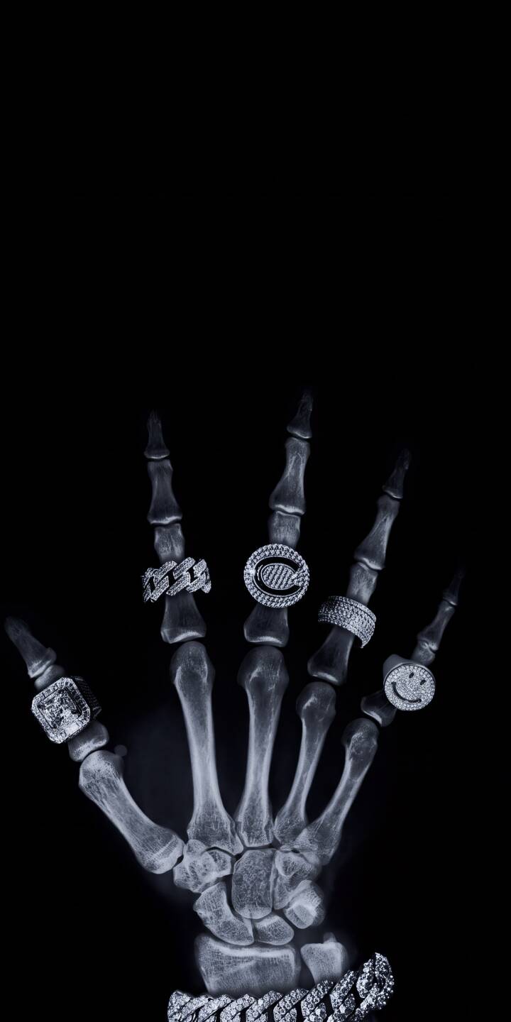 Gleaming diamond rings adorn an eerie X-ray skeletal hand, complete with a distinctive smiley face ring and a thick chain bracelet, creating a cool 4K wallpaper. This captivating digital art wallpaper is ideal for your iPhone, adding a touch of edgy style. | iphone wallpaper mobile 4k wallpaper hd wallpaper x-ray dark aesthetic edgy unique diamond rings bling skeleton hand Gleaming diamond rings adorn an eerie X-ray skeletal hand, complete with a distinctive smiley face ring and a thick chain bracelet, creating a cool 4K wallpaper. This captivating digital art wallpaper is ideal for your iPhone, adding a touch of edgy style.